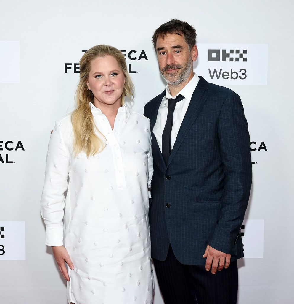 Amy Schumer and Chris Fischer Announce Amicable Split After Seven Years