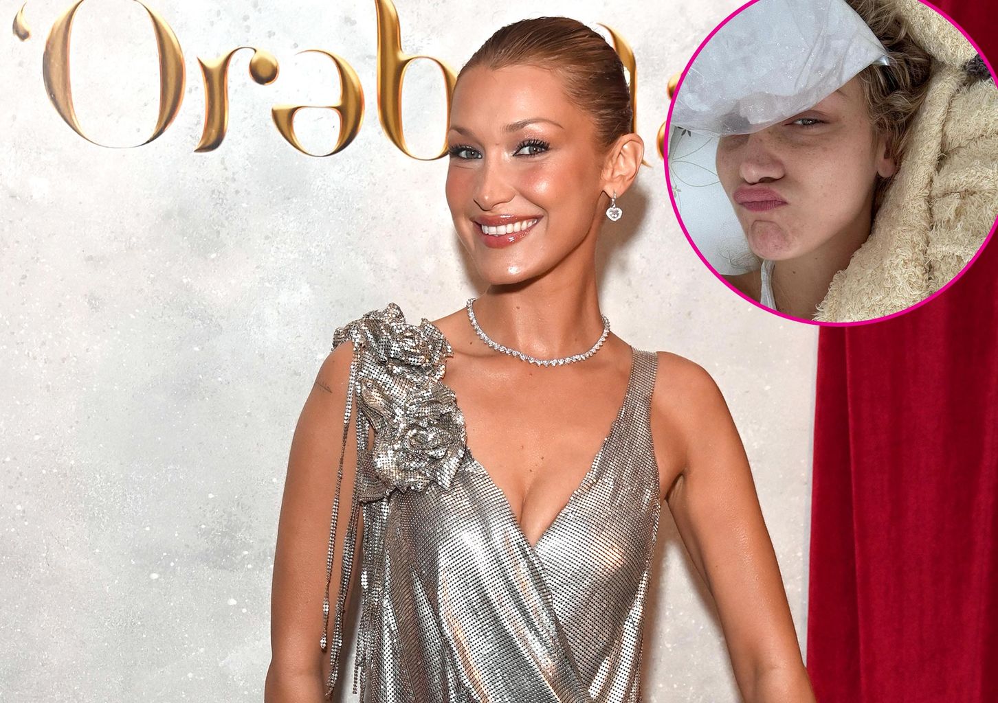Bella Hadid Shares Hospital Photos Amidst Ongoing Lyme Disease Battle